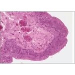 Light Micrograph of the Penile Urethra at Higher Magnification