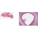 Low-magnification Light Micrograph of a Mature Ovary From a Dog With Light Micrograph of a Graafian Follicle