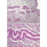 Light Micrographs of the Endometrium During the Early Follicular Phase at Low Magnification (Above) and Late Follicular Phase at Higher Magnification (Below)