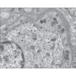 Electron Micrograph Showing a Synapse Between a Glomus Cell and a Nerve Terminal