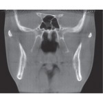 CT Image: Coronal View