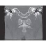 CT Image: Coronal View