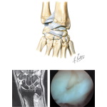 Ligaments of the Wrist