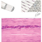 Dense Connective Tissue