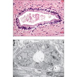 Biliary Duct System