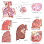 Runge IM 2E image