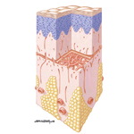 Burn Wound Healing With Autograft