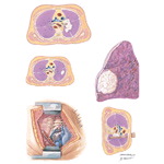 Radiation Therapy of the Lung