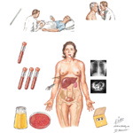 Diagnostic Consideratiosn In Fever of Unknown Origin