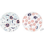 Malaria: Clinical Course and Diagnosis