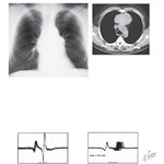 Complementary Exams for Neurologic Disorders