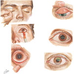 Diagnostic Approach to Ocular Diseases