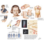Runge IM 2E image