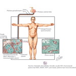 Runge IM 2E image
