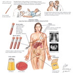 Runge IM 2E image