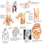 Runge IM 2E image