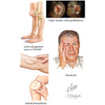 Runge IM 2E image