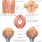 Anal Hook Extreme Bondage Labrador Anal Glands