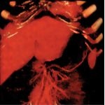 Porta Hepatis and Greater Omentum