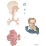 Nosocomial Infections: Particle Deposition In the Respiratory Tract