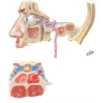 Traumatic Aneurysms of Carotid Artery As It Transverses the Skull