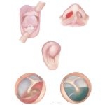 Child Abuse: Injuries to the Ears, Nose, and Mouth