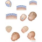 Dysmorphology: Direction of Hair Growth