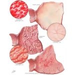 Smith 2E image