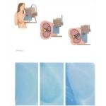 Mammography