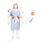 Diabetes Mellitus In Pregnancy