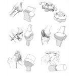 Synovial Joints