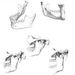 Mandible and Temporomandibular Joint