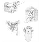 Muscles of the Tongue and Palate