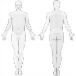 Dermatomes