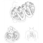 Heart II