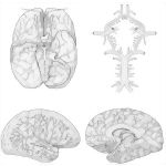 Arteries of the Brain