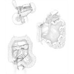 Arteries of the Gastrointestinal Tract
