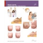 Breast Cancer Screening and Prevention