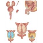 Diseases of Prostate: Treatment Considerations In Benign Prostatic Hypertrophy (BPH)