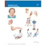 Managing Your Hypothyroidism