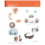 Managing Your Cataracts