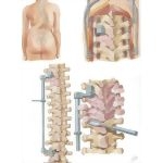 Spinal Fusion