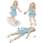 Obstructed Airway: Child Victim