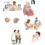 Managing Your Aortic Stenosis