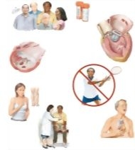 Managing Your Dilated Cardiomyopathy