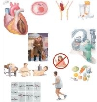 Managing Your Heart Attack