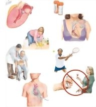 Managing Your Hypertrophic Cardiomyopathy