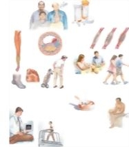 Managing Your Peripheral Arterial Disease