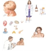 Managing Your Alopecia