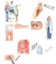 Managing Your Erythema Multiforme